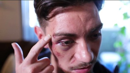 Denver Man Says He Was Attacked in Bar Parking Lot After Not Leaving Tip