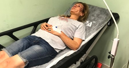 Balıkesir'de Talihsiz Kadın, Köpeklerini Gezdirirken Taşlı Saldırıya Uğradı