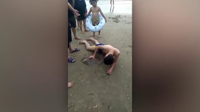 Cet homme s'est fait piquer les parties par une raie... Douloureux