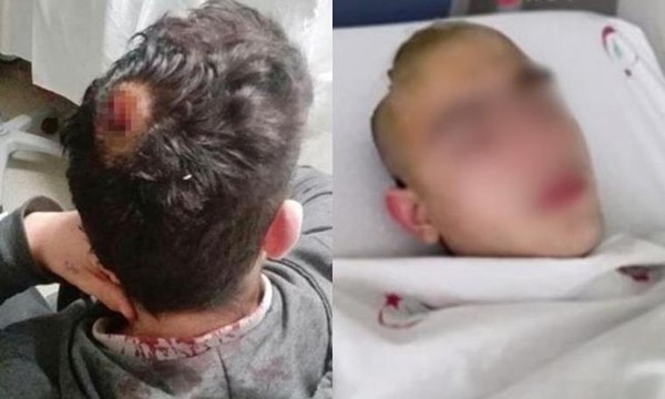 Liseli gence linç girişimi kamerada