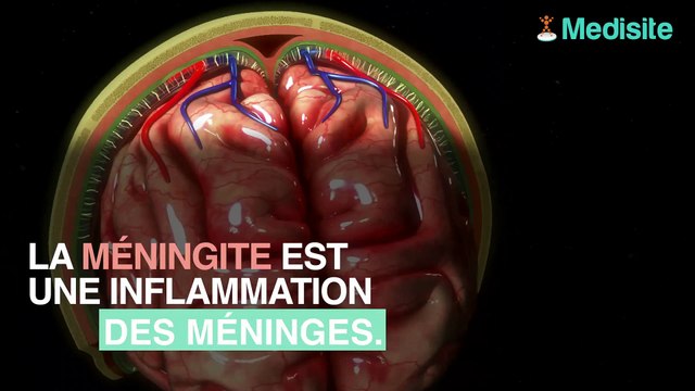 Méningite pourquoi ces symptômes doivent vous conduire aux urgences
