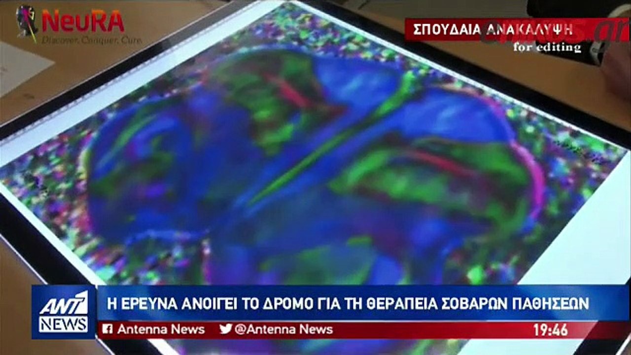 ΔΡ ΠΑΞΙΝΟΣ- ΕΓΚΕΦΑΛΟΣ