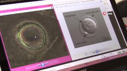 Erken Yumurtalık Yaşlanmasına Karşı Çığır Açacak Çözüm...yumurtalık Kaynaklı Yüzey Kök Hücreleri...