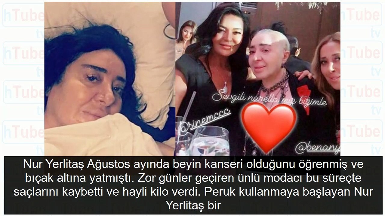 Nur Yerlitaş peruğu çıkarınca son hali ortaya çıktı işte o görüntüsü