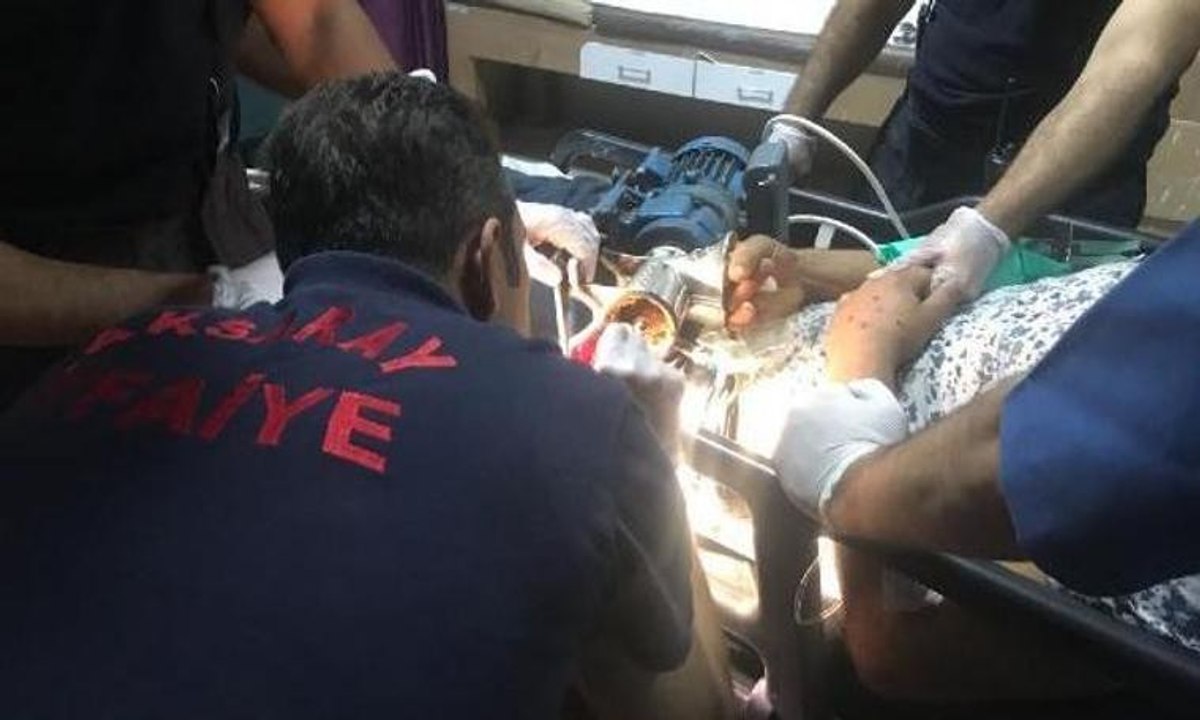 Elini kıyma makinesine kaptırdı