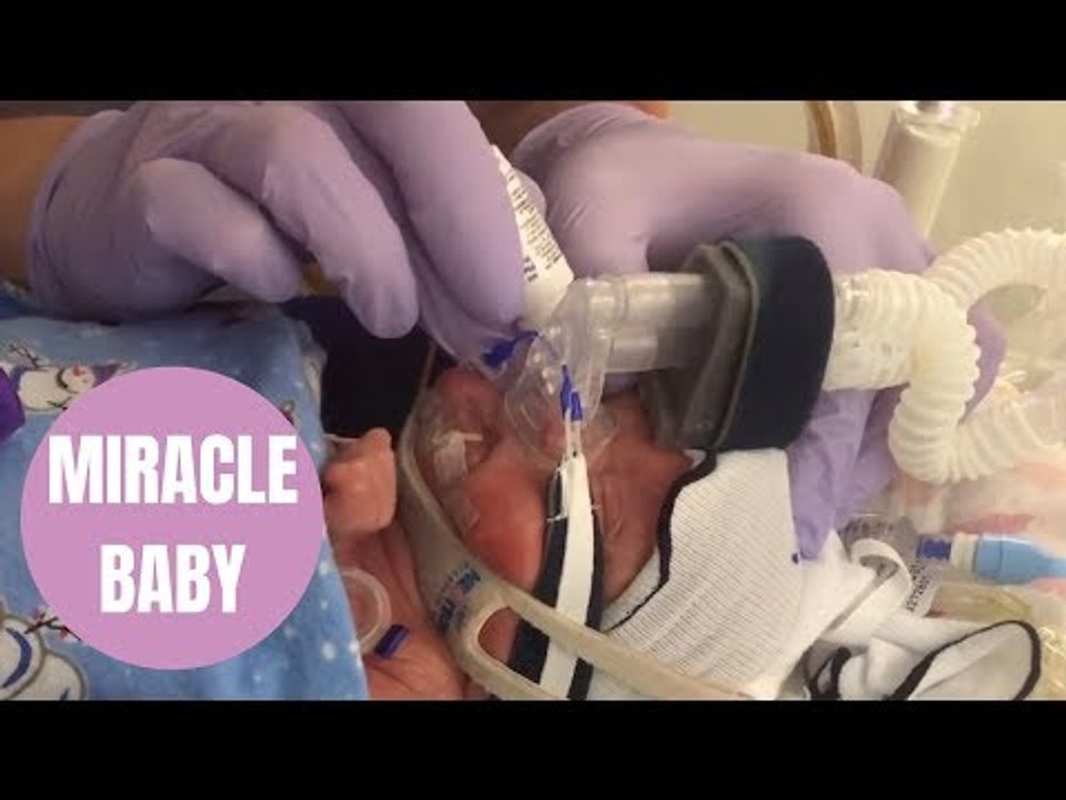 Meet incredible baby Grace born FOUR MONTHS premature