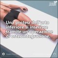 Come si inserisce una protesi ortopedica