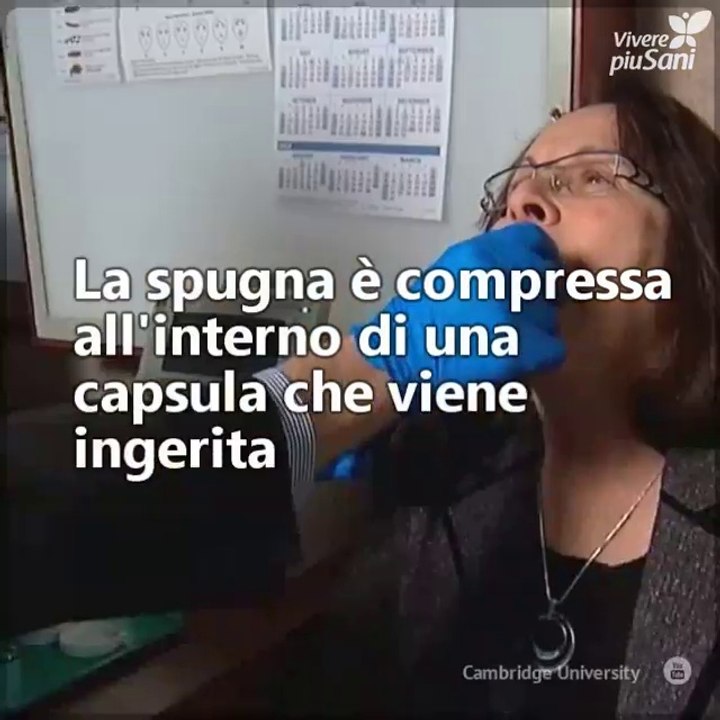 È possibile diagnosticare il tumore allo stomaco tramite una spugna?