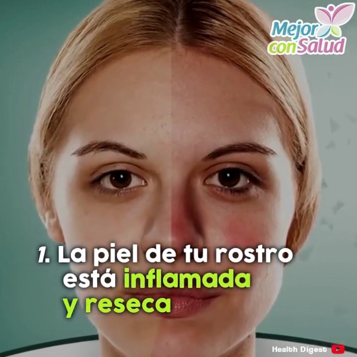 Nuestro cuerpo puede estar acumulando un exceso de toxinas sin saberlo.