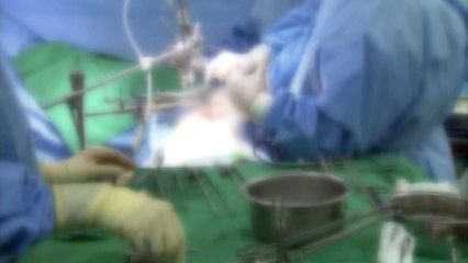 [취재N팩트] 의료기기 영업사원 증언 "대리수술은 관행" / YTN