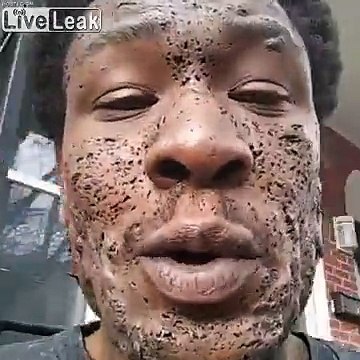 Le visage de cet homme est attaqué par une infection !