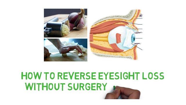 How to REVERSE Eyesight Loss Without Surgery or Glasses