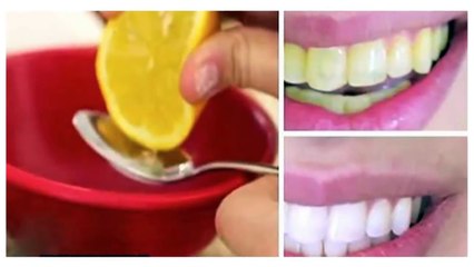Watch Your Teeth Get White In Just 2 Min With This Home Remedy