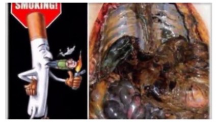 Health News - SMOKERS, ATTENTION: YOU CAN REMOVE ALL THE TOXINS FROM THE BODY IN 3 DAYS
