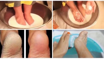 Health Tips - Just Two Ingredients from Your Kitchen Can Make Your Feet Look Amazing!