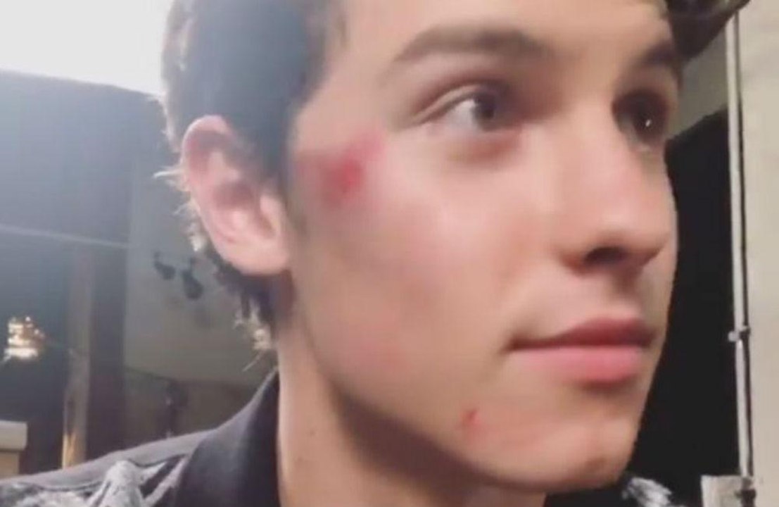 Shawn Mendes: Unfall!