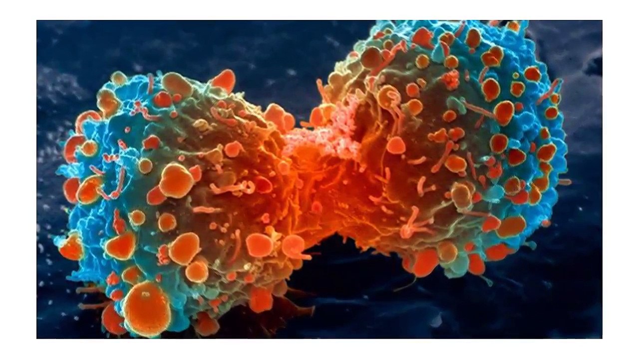 A Secret Has Been Uncovered: Cancer Is Not A Disease But Business!