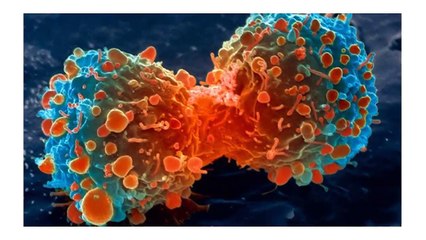 A Secret Has Been Uncovered: Cancer Is Not A Disease But Business!