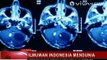 Ilmuwan Indonesia Ciptakan Pemindai Otak  Pertama di Dunia