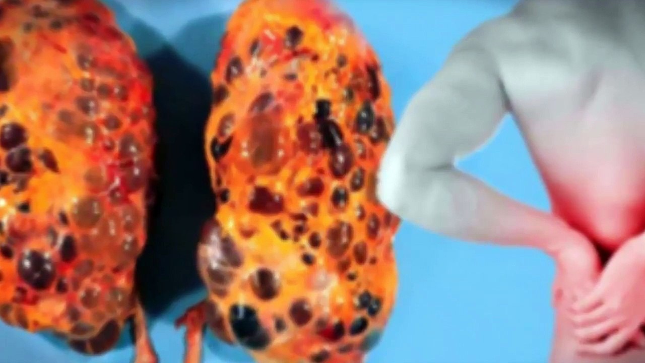 Top Ten Drugs That Cause Kidney Damage: Please Do Not Ignore This