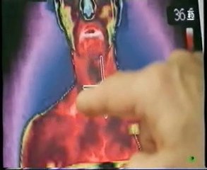 Estres agudo por frio y grasa parda (Obesidad): Michael Symons