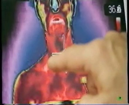 Estres agudo por frio y grasa parda (Obesidad): Michael Symons