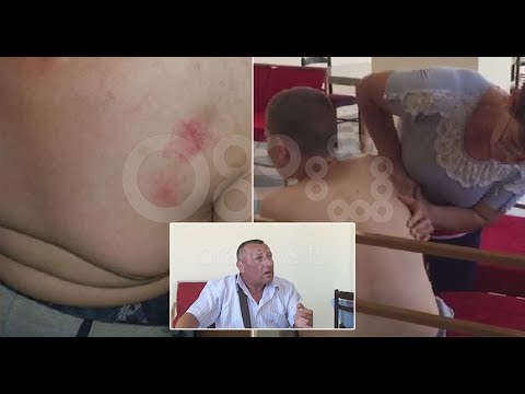 Ora News - Dhunohet fëmija autik? Babai i 12-vjeçarit akuza qendrës rezidenciale në Berat