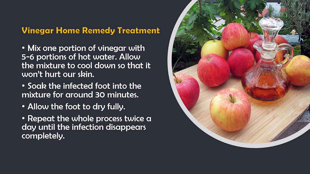 How To Cure Toenail Fungus Using Vinegar