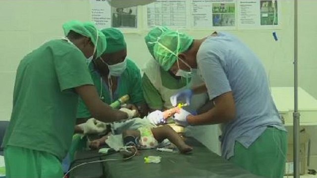 Peacekeepers conduct free cleft lip surgery in Somalia