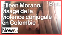 Colombie : Eileen Morano, le visage des violences conjugales