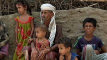 Akraba Evliliği Yüzünden, Yemen'de 200 Nüfuslu Köyde 70 Kör Oldu