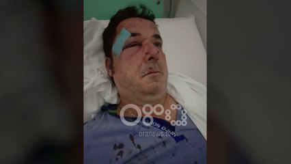 Ora News - Tiranë, biznesmeni dhunohet pranë banesës së tij tek Komuna e Parisit