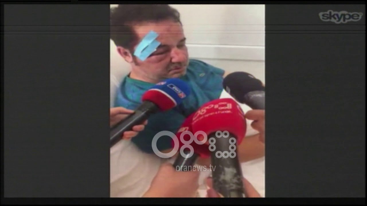 Ora News - Biznesmeni Zoga "pagoi" për konfliktin e të vëllait: Bandat më masakruan në mes të rrugës