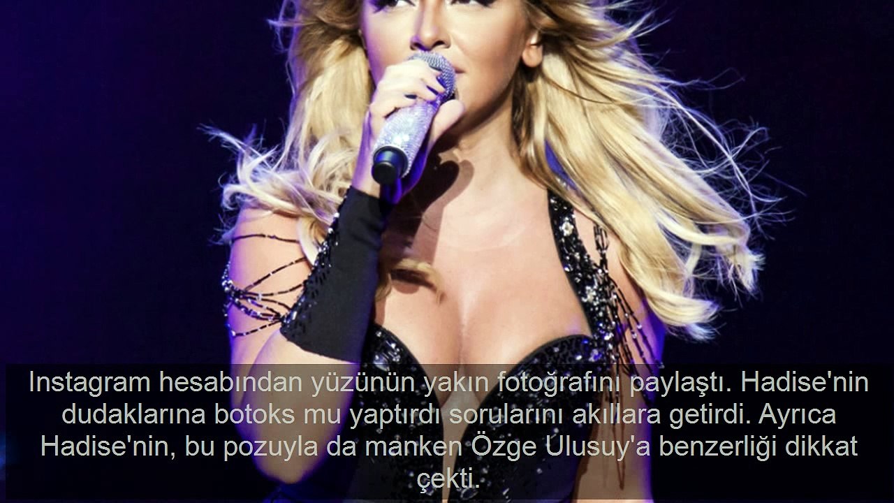 Hadise son görüntüsüyle hayrete düşürdü! Estetik kurbanı mı?