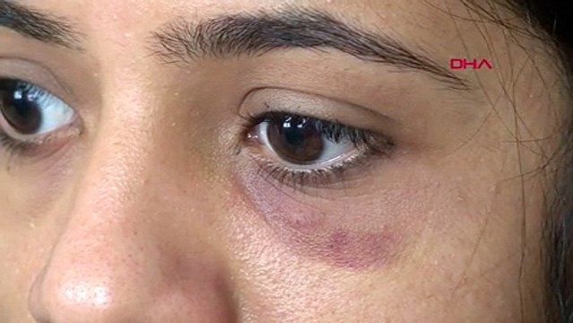 Semt pazarında 'ruj' kavgası