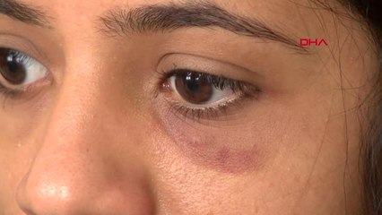 Antalya Semt Pazarında 'Ruj' Kavgası Hd