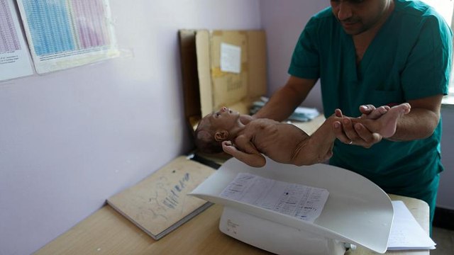 Jemen: Hungerkatastrophe könnte noch schlimmer werden