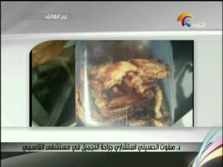 تقرير عن تجربة قاسية لشاب مع الهرمونات يتحدث لاخبار الدار