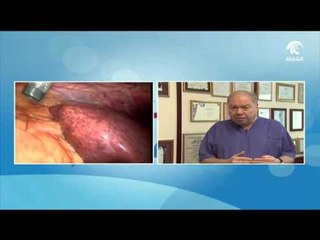 برنامج عطر المسا.. فقرة صحة العائلة - ما المقصود بالدهون الكبدية؟