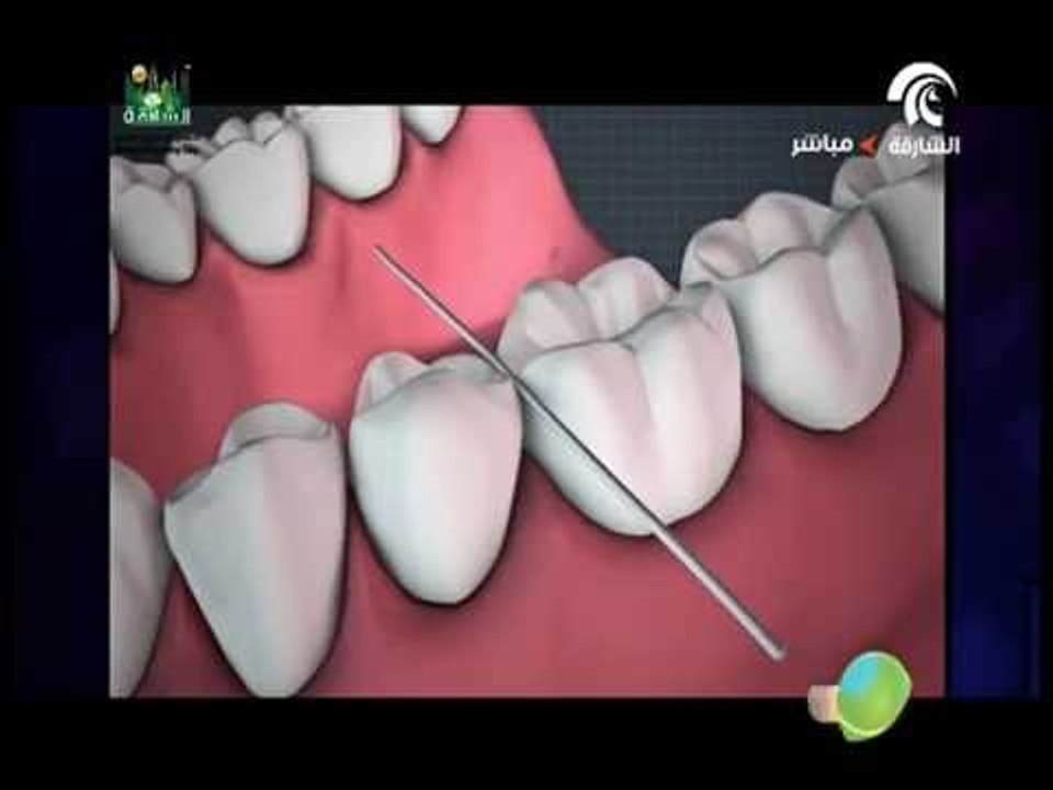 عادات خاطئة تسبب التهاب اللثة .
