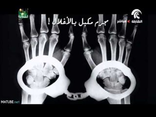 كيف يُرى العالم بمنظار الأشعة السينية