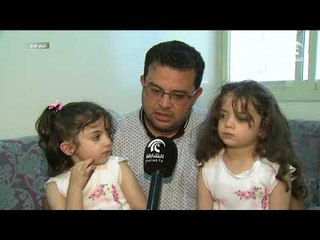 طفلتان شقيقتان بحاجة لزراعة قوقعة في الأذن بعدما ولدتا بمشكلة في الأذن