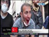 فيديو يوضح كيفية تعامل الشرطة مع المتظاهرين من ضرب وإعتقالات وقنابل غاز فى امريكا وفرنسا وتركيا