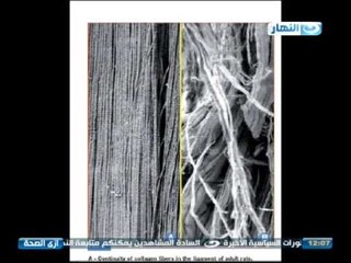 أزي الصحة - الآلام المزمنة