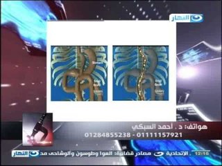 ازى الصحة : مشاكل السمنة