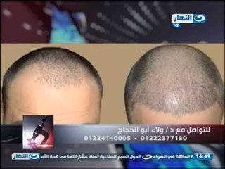 # برنامج ازى_الصحة | النظام الغذائى الصحي والأكل المفيد للبشرة وزراعة الشعر مع د. ولاء أبو الحجاج