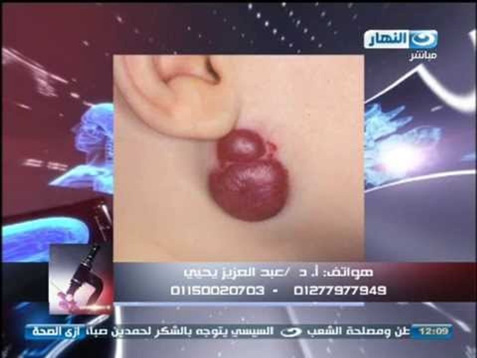ازى الصحة | دكتور عبد العزيز يحيي واجابة على اسئلة المشاهدين بخصوص تشوهات الاطفال