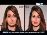 #Ezay_ElSeha /  برنامج #ازى_الصحة | العناية بالبشرة والجسم مع دكتورة راندا الشافعى