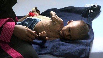 Millions of children threatened by famine in Yemen: charity
