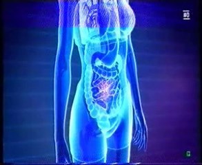 Insomnio y microbiota intestinal (Obesidad)